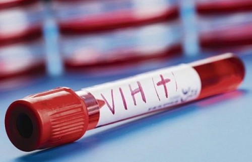Des chercheurs venus de France travaillent sur un vaccin contre le VIH–Sida à Libreville