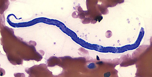 Des scientifiques camerounais mettent au point le Loascope, un appareil mesurant le niveau d’infection de l’onchocercose