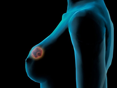 Cancers du sein et du col de l’utérus : l’Institut de cancérologie de Libreville dépiste 3721 femmes